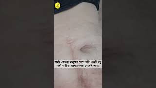 জানেন কি জন্মদাগের পিছনে কী রহস্য? | Best Bengal Shorts | Birth Mark Mystery |