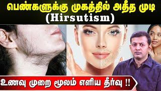 பெண்களுக்கு முகத்தில் அதீத முடி (hirsutism) | உணவு முறை மூலம் எளிய தீர்வு !! | Dr. Arunkumar