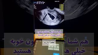 سونوهیستروگرافی بدون درده ، بشنوید از تجربه مراجعه کننده عزیزمون #سونوگرافی #سونوهیستروگرافی