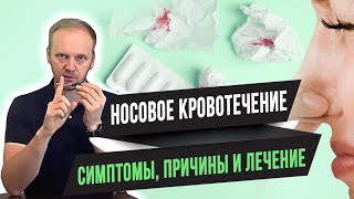 📚 Носовое кровотечение (симптомы, причины и лечение)