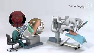 Robot Assisted Prostatectomy