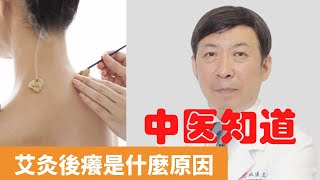 艾灸後癢是什麼原因【保健養生】生生不息┃