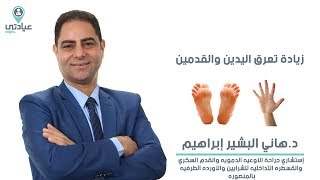 تعرق اليدين و القدمين مع د.هاني البشير إبراهيم - دكتور جراحة أوعية دموية بالمنصورة