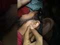 hydrogen peroxide Kan ki Safai ke liye Kaun 👂 my channel subscribe