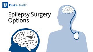 Epilepsy Surgery Options | Duke Health