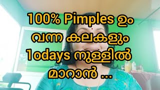 100% ഉറപ്പ് Pimples മാറാനും വന്ന കലകൾ മാറാനും 9 ദിവസം ഇങ്ങിനെ ചെയ്യൂ