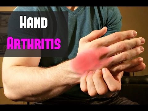 Fast Treatment for Hand Arthritis ~ Self Massage! Fast Treatment for Hand Arthritis ~ Self Massage!