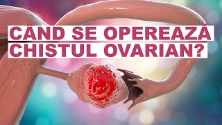 Chist ovarian: când trebuie operat?