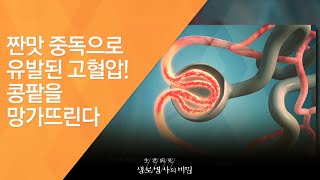 짠맛 중독으로 유발된 고혈압! 콩팥을 망가뜨린다 - (2016.9.21_594회 방송)_혈관을 겨누는 화살, 짠맛 중독