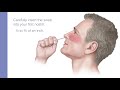 Direct Load Tube– SARS-CoV-2 Patient Collected Nasal Specimen Collection Guide