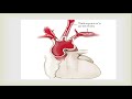 large arteries disease. gaint cell arteritis and takayasu s arteritis.