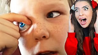 Kid Pulls Out His EYES.. (GONE WRONG)