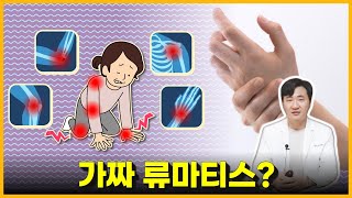 일반 통증질환이 '류마티스'로 둔갑하는 포인트? 진짜 류마티스 vs 가짜 류마티스 증상 구분하는 방법