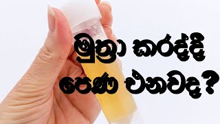 මුත්‍රා කරද්දී පෙන වගේද? Frothy urine ?