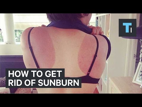 How to get rid of sunburn How to get rid of sunburn