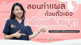 สอนทำแผลหลังเสริมจมูก ให้ถูกวิธีด้วยตัวเอง ลดโอกาสการเกิดแผลอักเสบ - หมอหลิว ต้นหลิวคลินิก