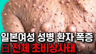 일본 의료붕괴 현실화, 日 여성 성병 통제불능 초비상사태