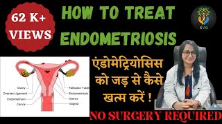 Treatment Of Endometriosis Without Surgery | Causes And Symptoms Of Endometriosis (Hindi)
