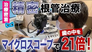 歯の中を21倍！マイクロスコープ【精密】根管治療