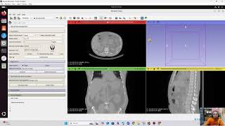 Absorbed Dose Calculation Using Monte Carlo Method: 3D OpenDose