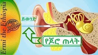 የጆሮ ኩክ በተገቢው  መንገድ ማስወገድ /How to Remove Ear Wax