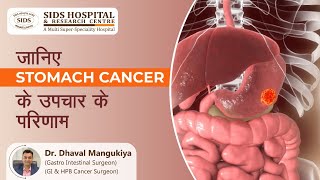 जानिए STOMACH CANCER के उपचार के परिणाम के बारे में | पेट के कैंसर (Hindi) - Dr. Dhaval Mangukiya