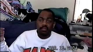this is Bell's Palsy