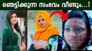 വീണ്ടും ഞെട്ടിക്കുന്ന ആസിഡ് ആക്രമണം Alfala vinoj khan Thanseer koothuparamba New album