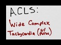 Approach to Wide Complex Tachycardia