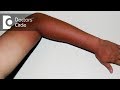 What to do when face is darker than body? - Dr. Rasya Dixit What to do when face is darker than body? - Dr. Rasya Dixit