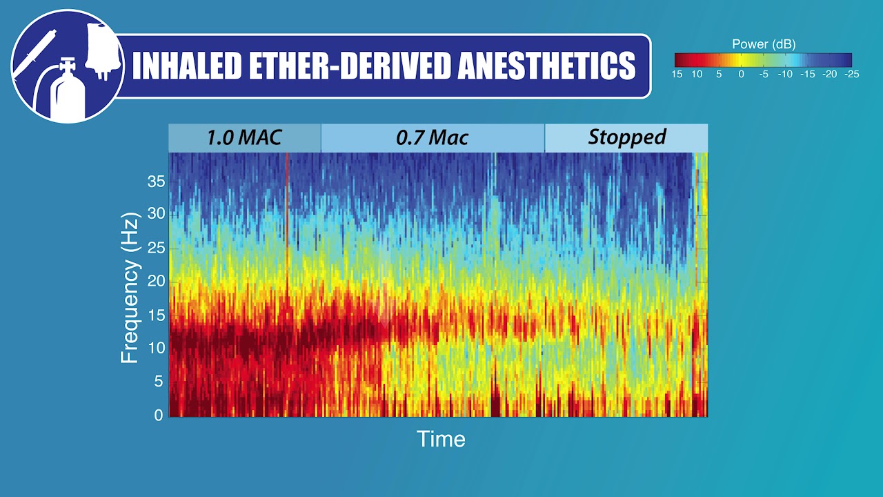 EEG For Anesthesiology - Part 4: Inhaled Ether-derived Anesthetics ...