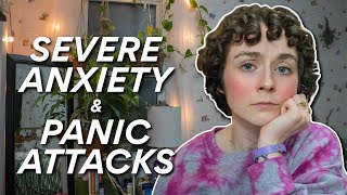 How I Cope With Severe Anxiety and Panic Attacks // living with GAD // just surviving my own mind