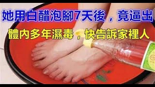 沒想到她用白醋泡腳7天後，竟逼出體內多年濕氣，快告訴家裡人~