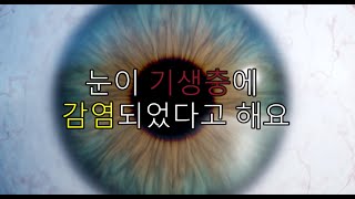 눈이 기생충에 감염되었다고 해요