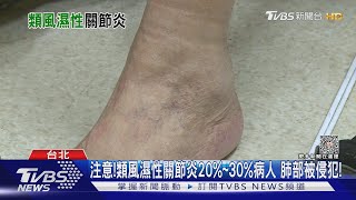 罹「這疾病」...小心肺部纖維化...拖延病情...死亡風險高!｜十點不一樣20231024@TVBSNEWS01