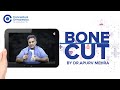 Bone Cut by Distinguished Educator & Dynamic Ortho Surgeon Dr.Apurv Mehra @ConceptualOrthopedics