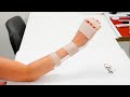 Multifit NS Resting Hand Orthosis