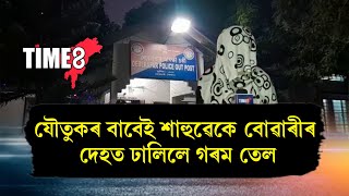 শাহুৱেকে বোৱাৰীৰ দেহত ঢালিলে গৰম তেল। যৌতুকৰ বাবেই বোৱাৰীক নিৰ্যাতন।