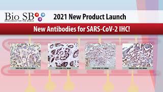 Bio SB - 2021 New Product Launch - Including 66 new IHC Antibodies!