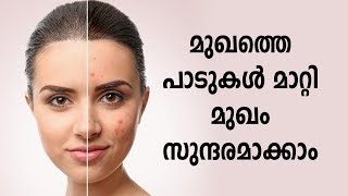 മുഖത്തെ പാടുകൾ മാറ്റി മുഖം സുന്ദരമാക്കാം | Beauty Tips In Malayalam, Healthy Kerala