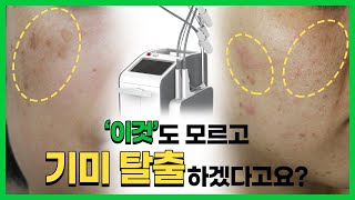 기미잡티레이저추천 – 집착의 끝판왕 기미잡티없애기 ㅇㅇㅇ레이저면 헤어질 수 있다고??