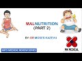 Malnutrition || Part 2