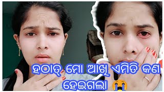 ହଠାତ୍ ମୋ ଆଖି ଏମିତି କଣ ହେଇଗଲା 😭🥺//#odiavlogs #odiajhia @runilifestyle4