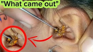 EAR CLEANING IN INDIAN STREET | WHAT CAME OUT |EAR CLEANING | EAR WAX REMOVAL