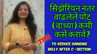 सिझेरियननंतर  वाढलेले पोट कमी करण्यासाठी उपाय l How to reduce Belly after  Ceaserian Delivery