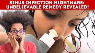 Spectacular Sinus Infection - Must Watch