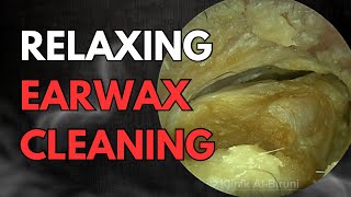 Relaxing Earwax Cleaning ASMR