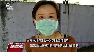 台南女童雙腳燙傷潰爛 繼父坦承施虐 20200628 公視晚間新聞