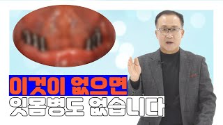 [치과튜브] 임플란트 하신분 꼭 보세요