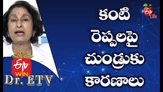 Dandruff On Eyelashes | కంటి రెప్పలపై చుండ్రుకు కారణాలు | Dr.ETV | 21st December 2020  | ETV Life